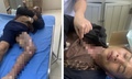 Leo trạm biến áp cắt trộm dây điện, hai người bị điện giật bỏng nặng