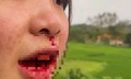 Đang xác minh vụ tài xế ô tô hành hung cô gái chảy máu mũi ở Bắc Giang