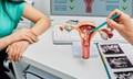 Ra m&#225;u &#226;m đạo bất thường c&#243; phải l&#224; dấu hiệu mắc ung thư cổ tử cung?