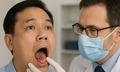 8 nguy cơ g&#226;y ung thư miệng &#237;t ai ngờ tới