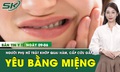 Bản Tin Y Tế 9/6: &#39;Y&#234;u&#39; bằng miệng, người phụ nữ 32 tuổi nhập viện cấp cứu, trật khớp quai h&#224;m