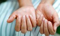 Bổ sung vitamin v&#224; kho&#225;ng chất n&#224;o khi m&#243;ng tay gi&#242;n, dễ g&#227;y?