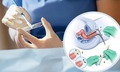 C&#225;ch tốt nhất để ph&#225;t hiện sớm ung thư cổ tử cung