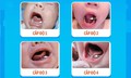 Dị tật bẩm sinh khiến trẻ kh&#243; b&#250;, kh&#243; ph&#225;t &#226;m