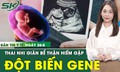 Bản Tin Y Tế 26/8: Thai nhi 28 tuần đa ối, gi&#227;n bể thận do đột biến gene