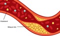 9 c&#225;ch tự nhi&#234;n gi&#250;p giảm cholesterol xấu, bảo vệ tim mạch