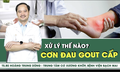 Cơn đau gout cấp xử l&#253; thế n&#224;o?