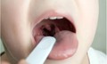 Viêm mũi họng kéo dài ảnh hưởng gì đến sức khỏe trẻ?