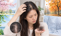 Rụng tóc ở phụ nữ: Nguyên nhân và cách khắc phục