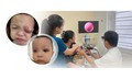 Trẻ 18 tháng tuổi nguy cơ mất thị lực do viêm xoang biến chứng