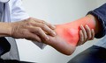 Bệnh gout không chỉ do ăn uống