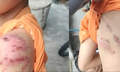 Công an điều tra vụ bé trai nghi bị cha ruột đánh