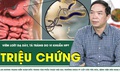 [LIVE] Triệu chứng viêm loét dạ dày, tá tràng do vi khuẩn HP
