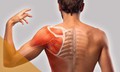 Đau vai, hạn chế cử động tay cảnh giác với đông cứng khớp vai