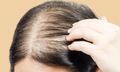 5 thói quen gây hại khiến tóc ngày càng mỏng đi