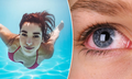 Cách bảo vệ mắt khi đi bơi