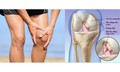 Đau khớp gối khi leo cầu thang có đáng lo?