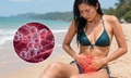 Sai lầm khi đi biển khiến viêm âm đạo do nấm tái phát nhiều lần