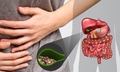Bệnh sỏi túi mật phổ biến nhưng thường bị xem nhẹ, cảnh báo biến chứng nặng