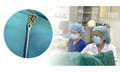 Bỏ quên vòng tránh thai suốt 30 năm, người phụ nữ 63 tuổi gặp biến chứng phụ khoa
