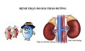 Thuốc SGLT2i - Bước tiến mới bảo vệ thận cho người bệnh đái tháo đường