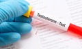 Giảm testosterone ở nam giới: Những dấu hiệu cảnh báo không nên bỏ qua