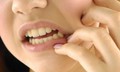 Viêm xương hàm hay bị bỏ qua do triệu chứng dễ nhầm với bệnh răng miệng thông thường