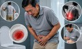 Nam giới 50 tuổi vì sao cần tầm soát ung thư tuyến tiền liệt?