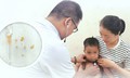 Cứu sống bé trai 2 tuổi hóc hạt lạc, bít kín hai bên phế quản