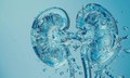 Dấu hiệu cảnh báo thận đang suy yếu