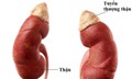 Nhận biết sớm dấu hiệu suy tuyến thượng thận ở trẻ