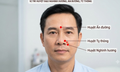 Dưỡng sinh cho người viêm mũi dị ứng theo mùa