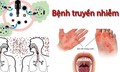 Cắt đứt nguồn lây bệnh truyền nhiễm: Từ chính sách đến thực tế đời sống