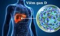 HIV và viêm gan D mạn tính: Vì sao cần đặc biệt lưu ý?