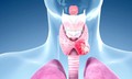 Điều trị ung thư tuyến giáp cần cá thể hóa