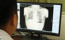 Bệnh nghề nghiệp ảnh hưởng sức khỏe, t&#237;nh mạng người lao động c&#243; xu hướng tăng