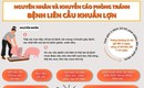 Ngành Y tế khuyến cáo thay đổi thói quen ăn uống để phòng liên cầu lợn