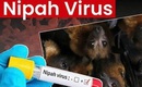 Bộ Y tế hướng dẫn chẩn đoán và điều trị bệnh truyền nhiễm do virus Nipah