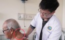 Mang khối u hơn 40 năm, cụ ông 72 tuổi được phẫu thuật thành công