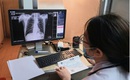 Bệnh viện Phổi Trung ương triển khai xe X-quang lưu động tại Ngày Sức khỏe toàn dân 7/4