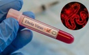 WHO cảnh báo khẩn về Ebola, Bộ Y tế yêu cầu tăng cường giám sát, ngăn dịch xâm nhập
