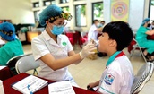 Hơn 90% d&#226;n số Việt Nam gặp phải c&#225;c vấn đề về răng miệng