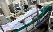 Người phụ nữ ‘sốc’ nặng v&#236; sau 2 năm niềng răng ph&#225;t hiện
ch&#226;n răng bật ra khỏi xương 