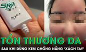Nữ sinh bị tổn thương da nghi&#234;m trọng sau khi d&#249;ng kem chống nắng SPF 70 ‘x&#225;ch tay’