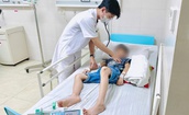 B&#233; trai 9 tuổi vỡ l&#225;ch độ III, chảy m&#225;u trong ổ bụng được cứu sống