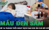 M&#225;u b&#233; g&#225;i chuyển m&#224;u đen sẫm sau khi ăn cải b&#243; x&#244;i nấu bằng nước giếng tại nh&#224;