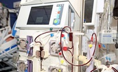 TPHCM: Lợi dụng cơ chế tự c&#244;ng bố, nhiều đơn vị hạ mức rủi ro thiết bị y tế để c&#244;ng bố, dễ tr&#250;ng thầu