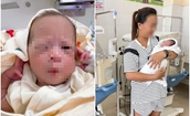 Giành giật sự sống cho bé gái sinh non bị suy hô hấp từ người mẹ mắc hội chứng HELLP