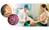 Cứu sống trẻ mắc bệnh Whitmore nguy hiểm