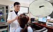 Bắt đỉa sống trong thanh quản người phụ nữ có thói quen uống nước ở suối